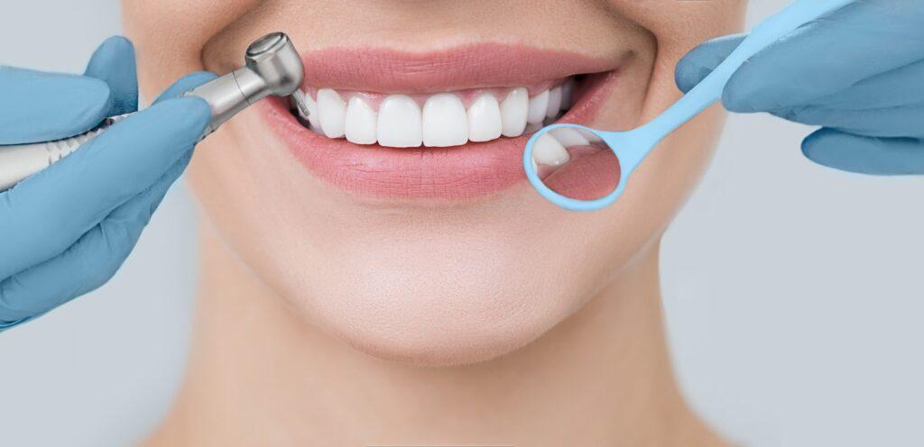 Abgeschnittenes, perfektes Lächeln und Zahnarzthände, die einen Zahnbohrer und einen Winkelspiegel halten. Zahnheilkunde und Zahnbehandlung